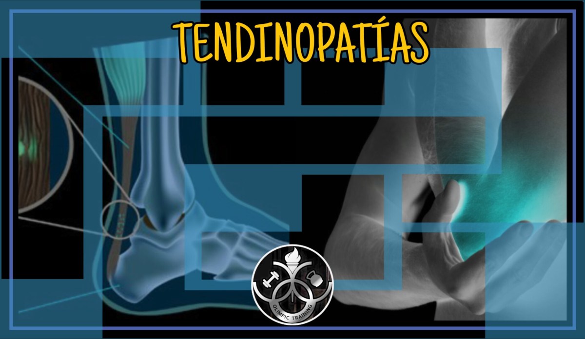 Tendinopatías